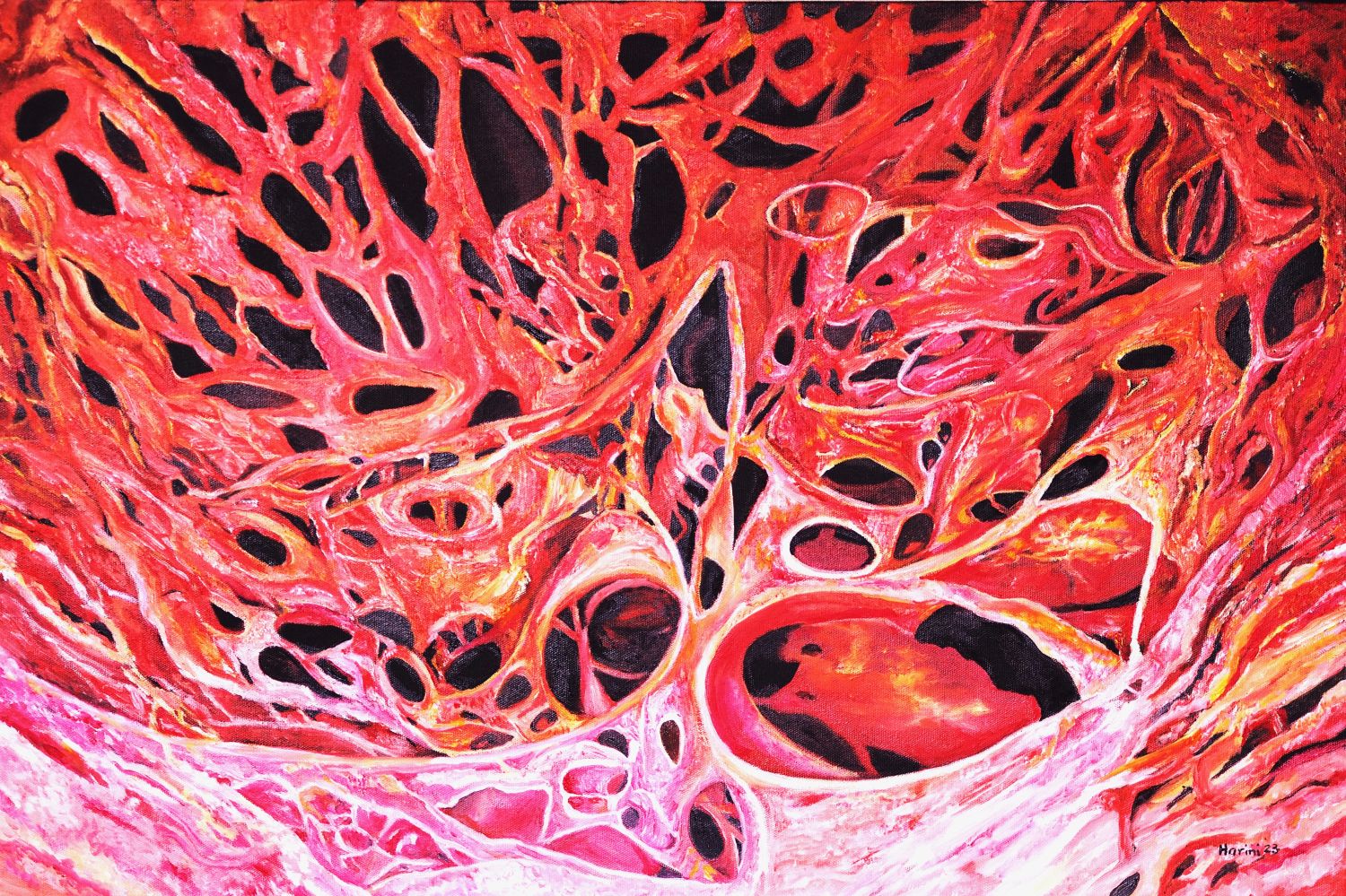 Chordae of right atrium-- Heart